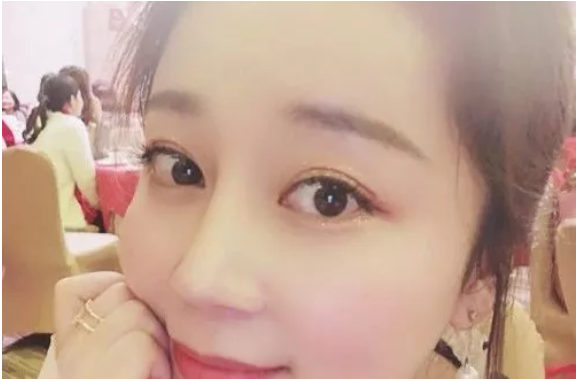 武汉五洲莱美整形美容医院刘俊怎么样？附价格表及鼻修复案例