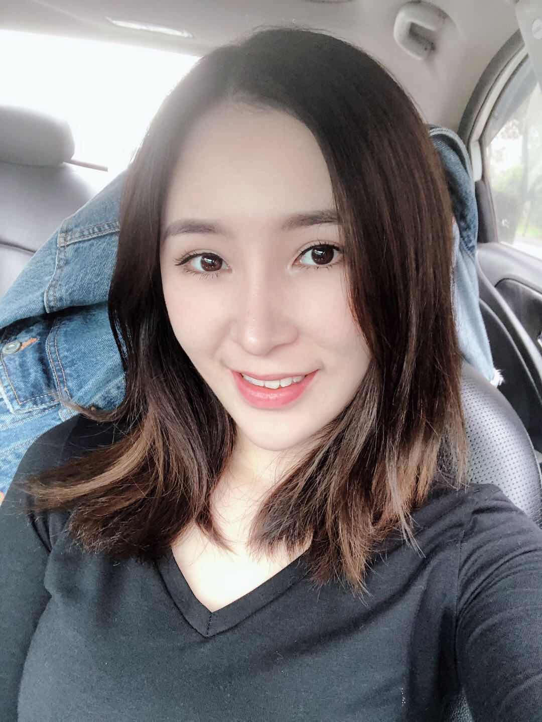 山西武警总医院整形美容科价格表及双眼皮案例