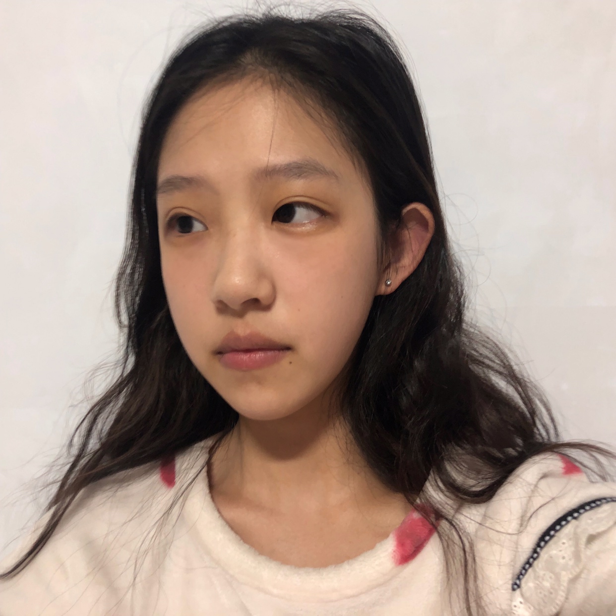 杭州美莱医疗美容医院价格表，附隆鼻案例