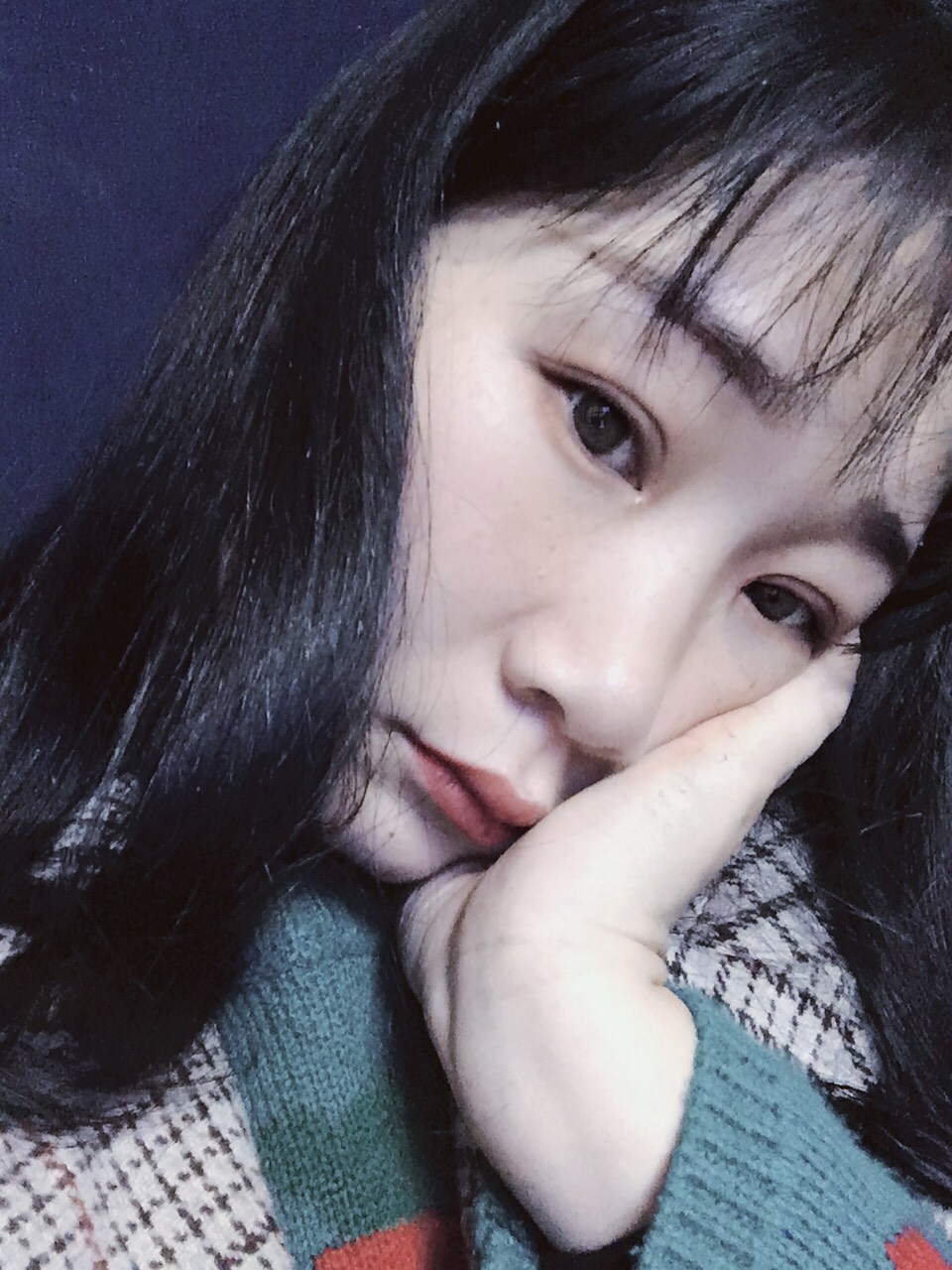 广州越秀紫馨曹仁昌双眼皮修复怎么样?附双眼皮修复案例