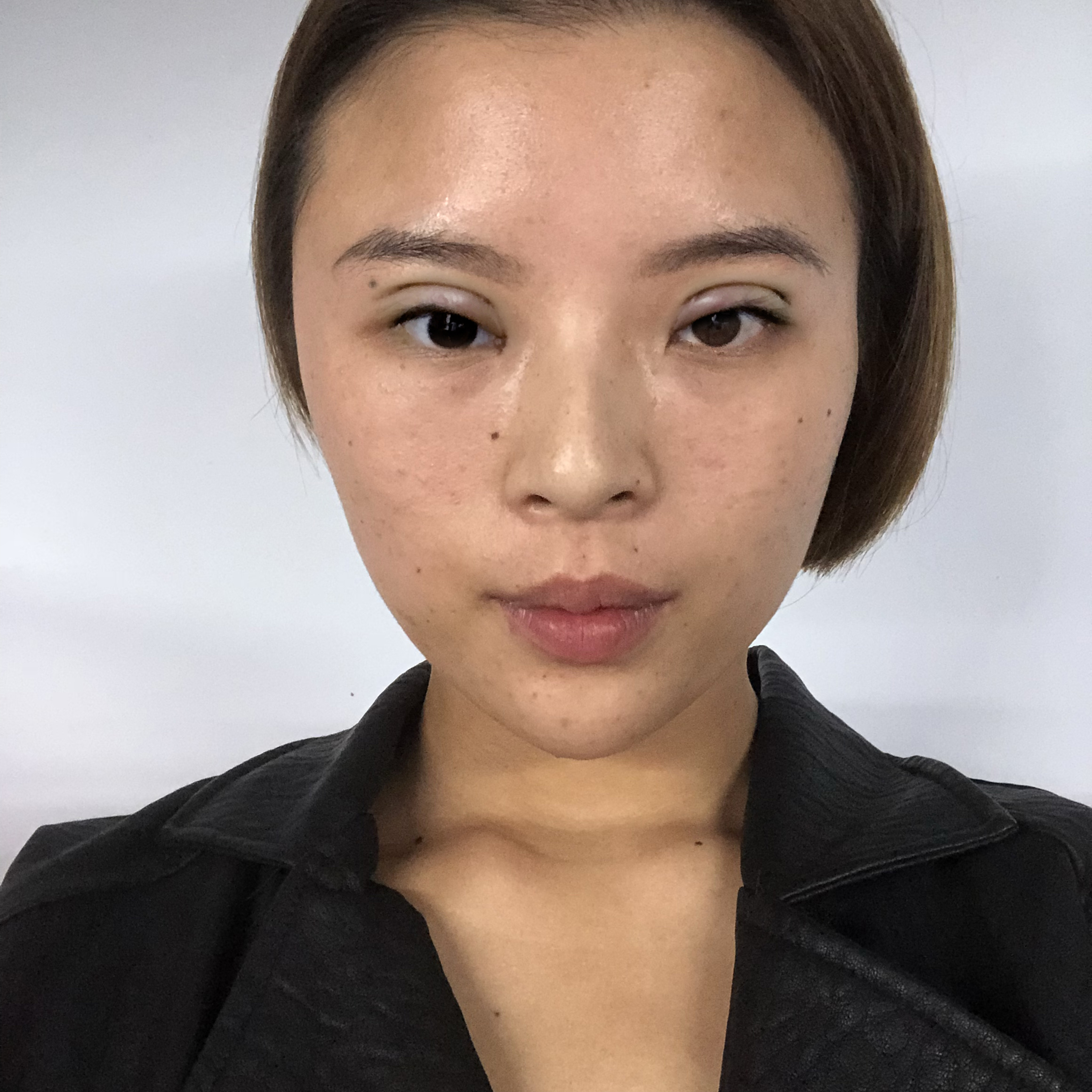 郑州爱美丽整形美容崔黎丹做双眼皮怎么样？附双眼皮案例及价格表