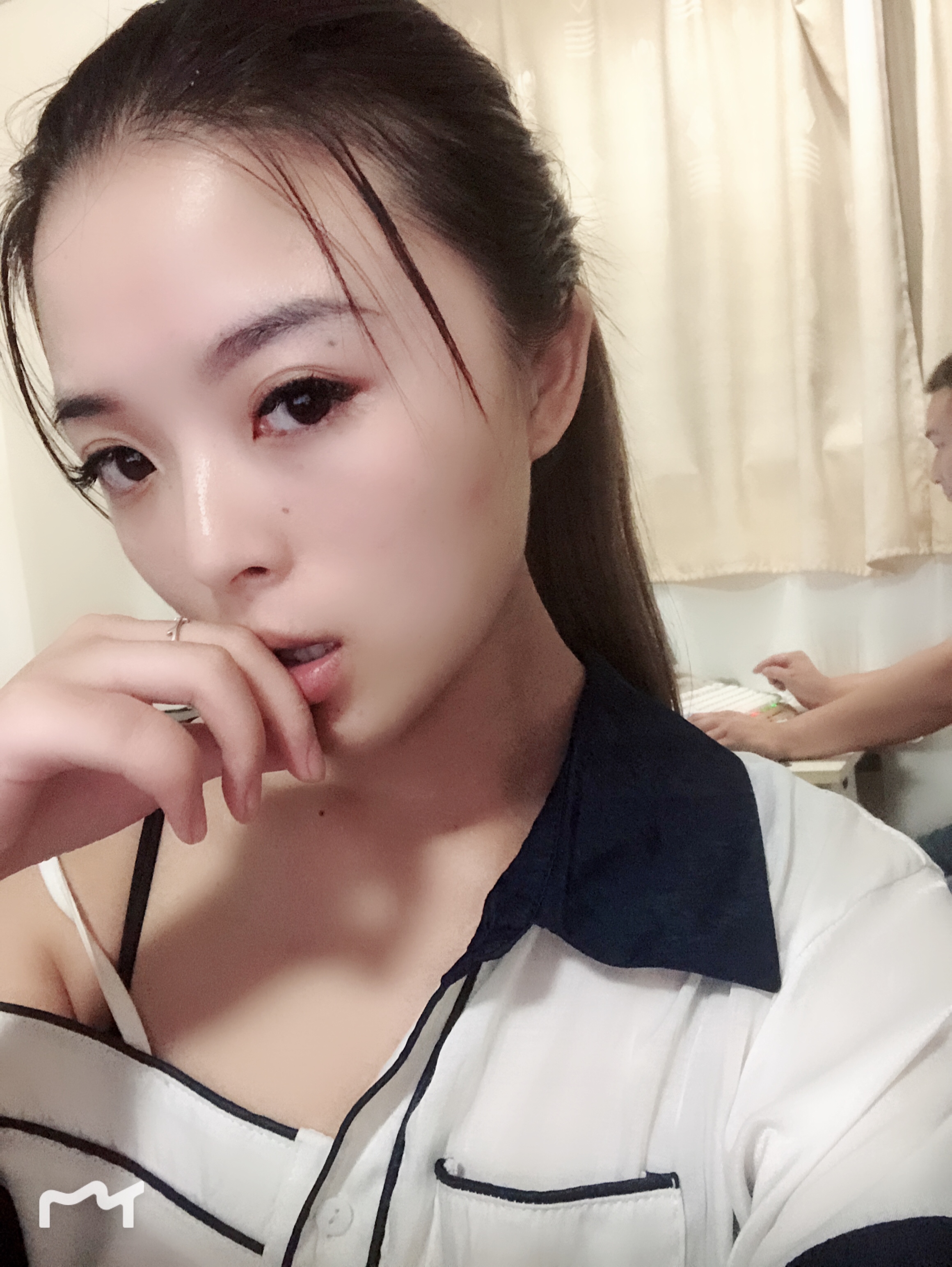 郑州爱美丽整形美容崔黎丹做双眼皮怎么样？附双眼皮案例及价格表