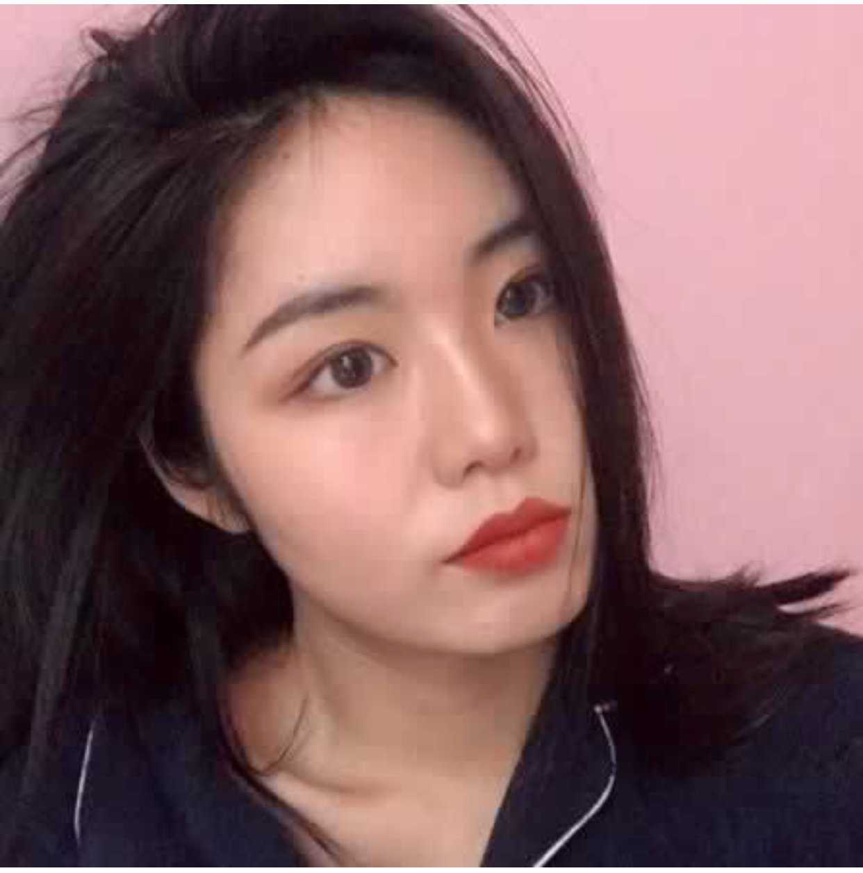 成都美未央医疗美容价格表，附假体垫眉弓真人案例