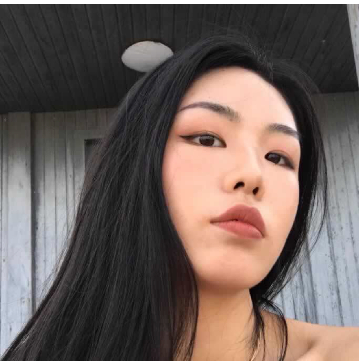 成都美未央医疗美容价格表，附假体垫眉弓真人案例