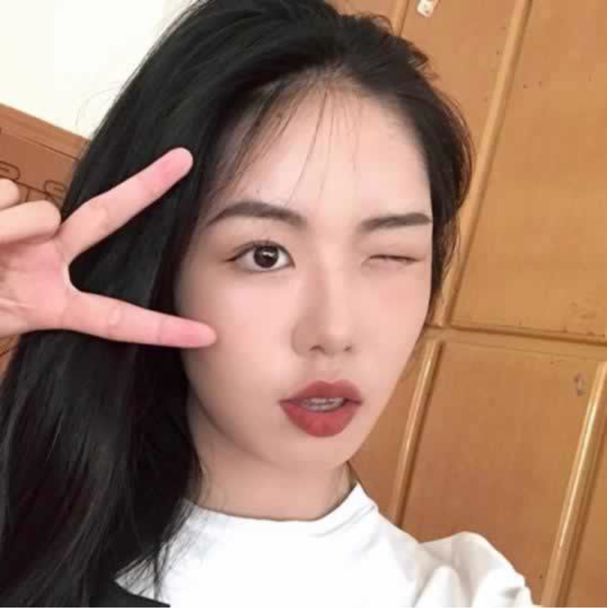 成都美未央医疗美容价格表。附假体垫眉弓真人案例