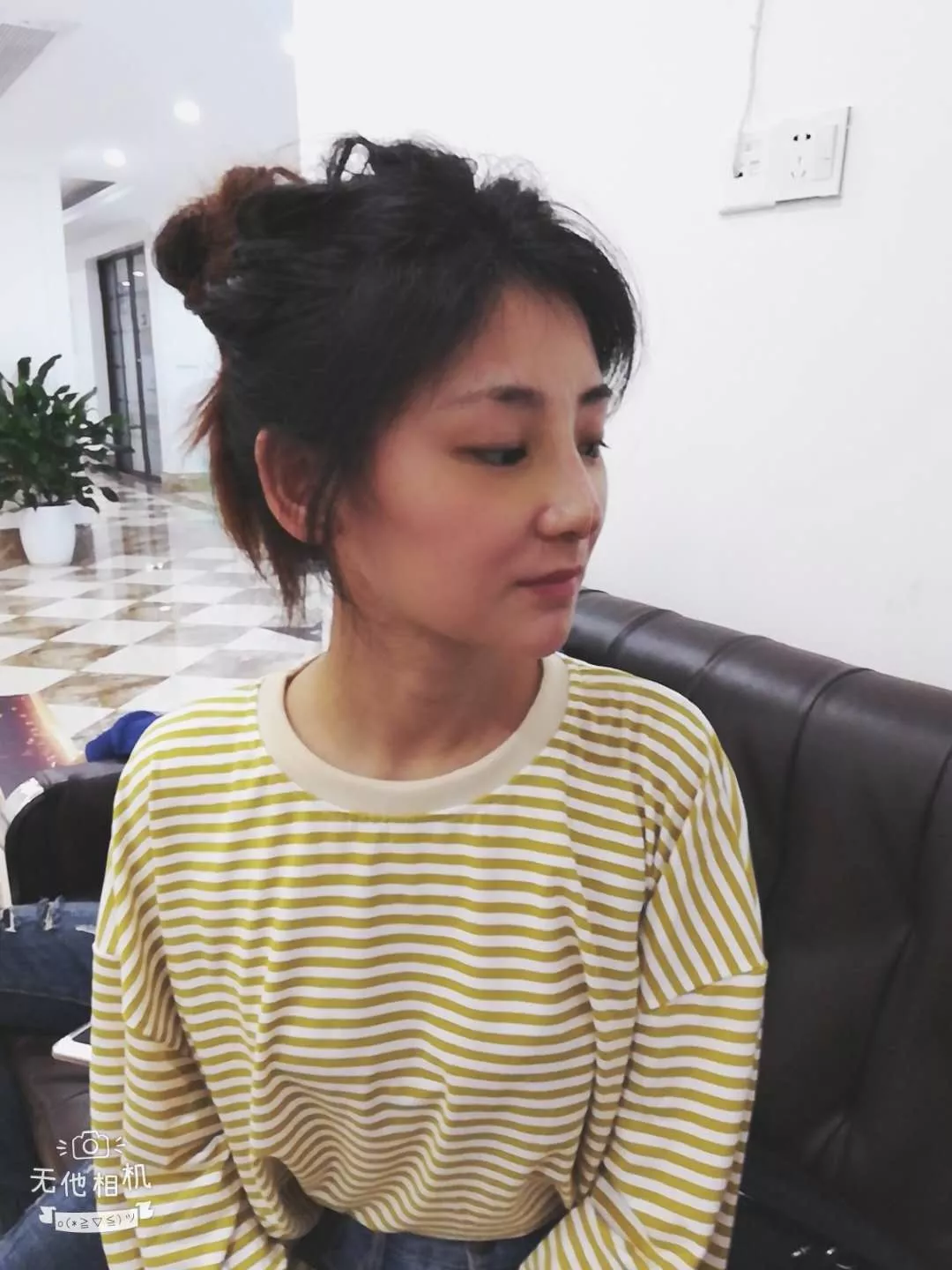 宁波壹加壹整形美容医院价格表，附隆鼻真人案例分享