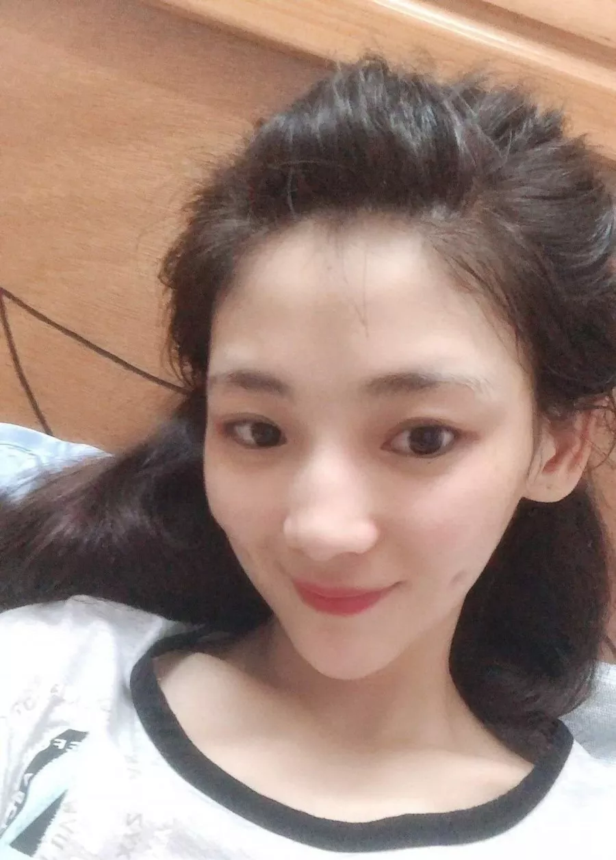 宁波壹加壹整形美容医院价格表，附隆鼻真人案例分享