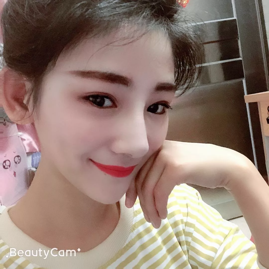宁波壹加壹整形美容医院价格表，附隆鼻真人案例分享