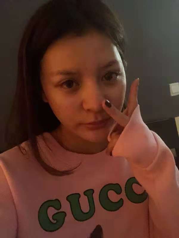 大连康桥整形医院价格表，附假体隆鼻案例