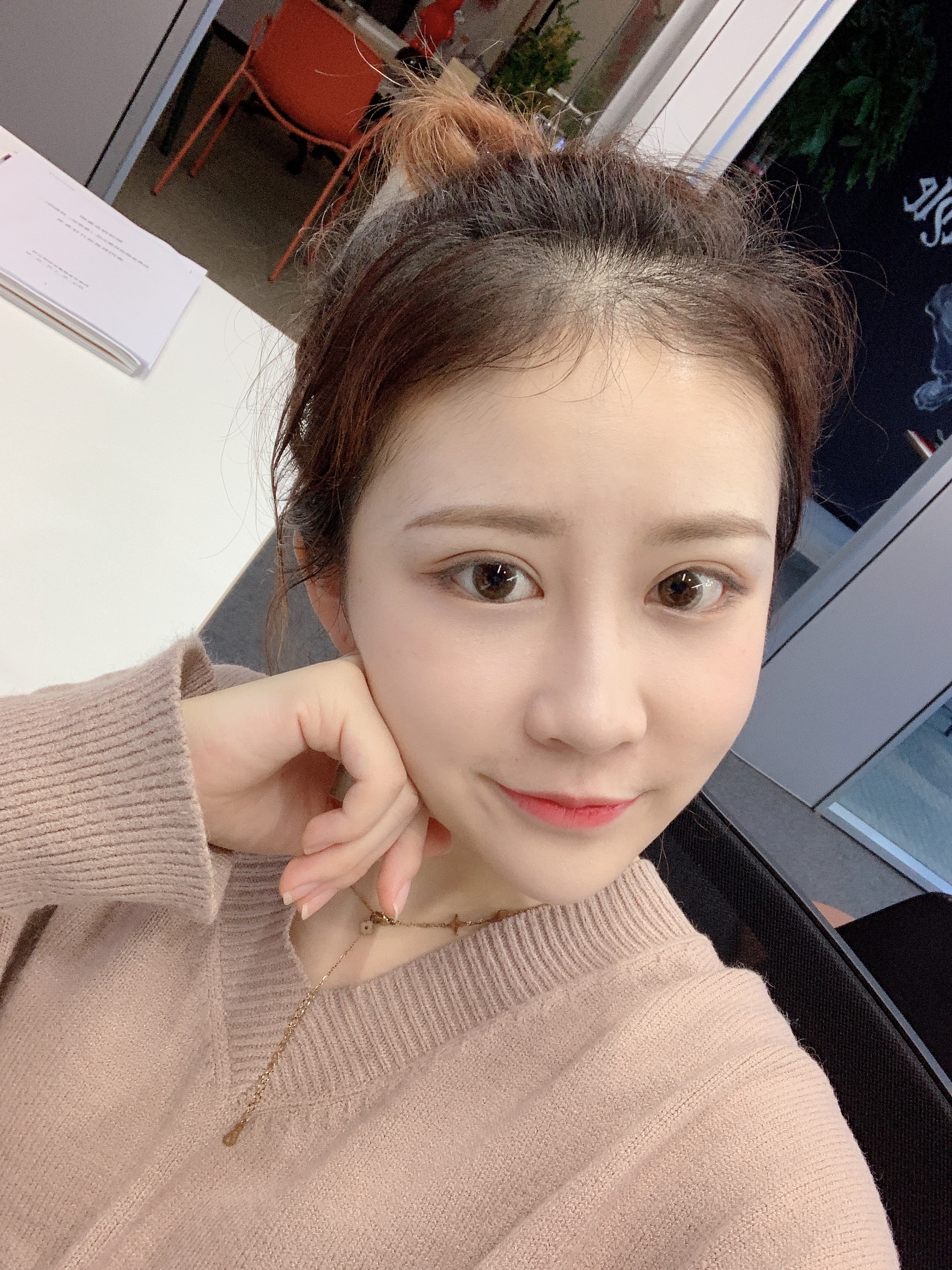 成都圣丹福整形美容医院2020年价格表，附双眼皮案例