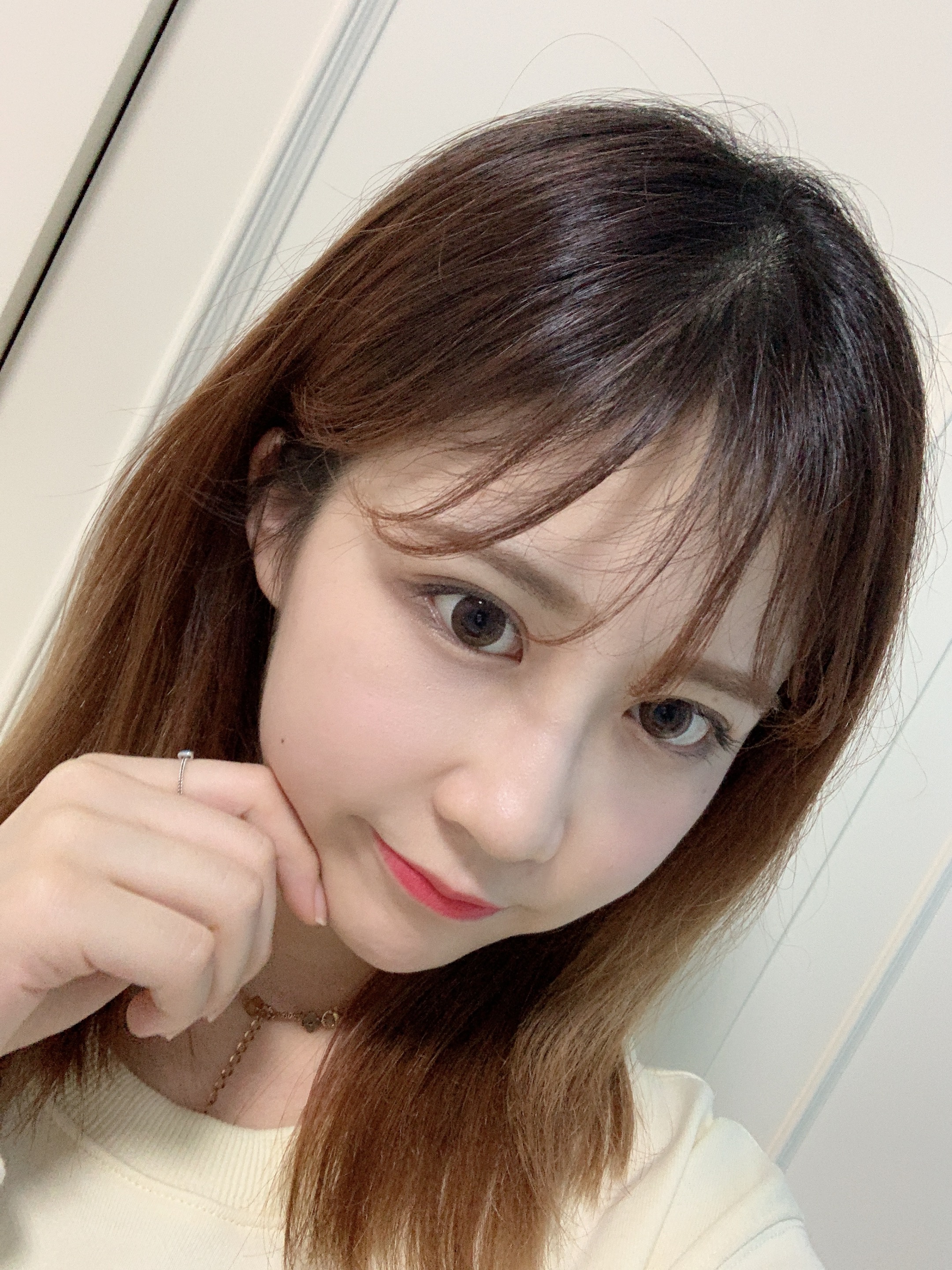 成都圣丹福整形美容医院2020年价格表，附双眼皮案例