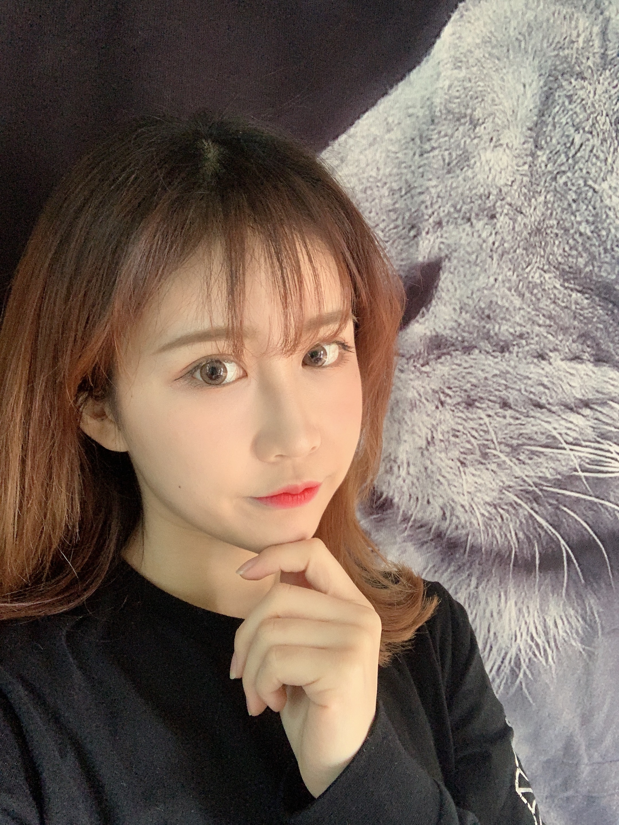 成都圣丹福整形美容医院2020年价格表，附双眼皮案例