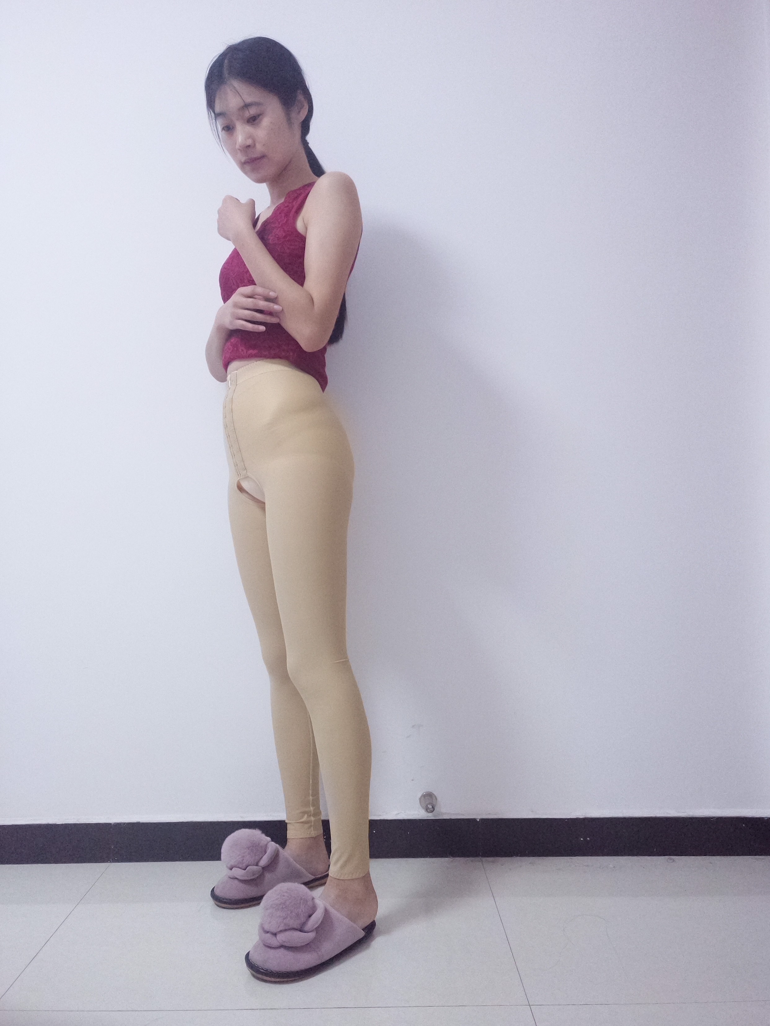 重庆珂琳雅整形美容王陈做吸脂手术怎么样?附吸脂瘦大腿案例及价格表
