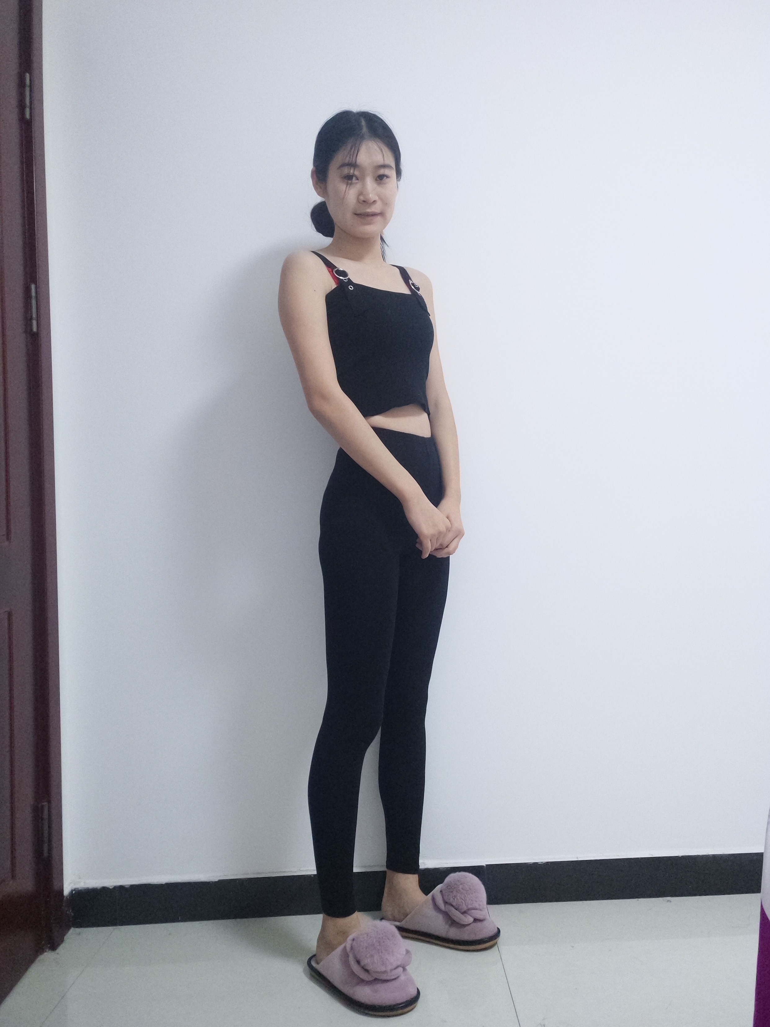 重庆珂琳雅整形美容王陈做吸脂手术怎么样？附吸脂瘦腿案例及价格表