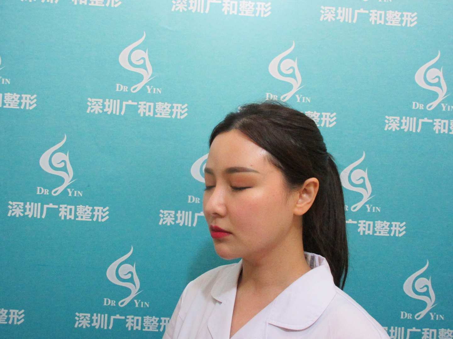 深圳广和整形美容门诊部价格表，附硅胶垫下巴案例恢复过程图