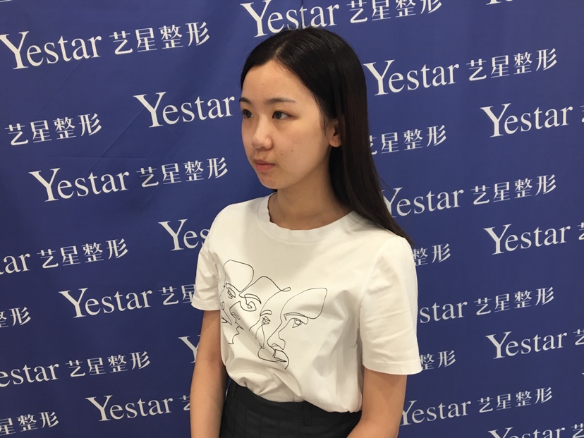 宁波艺星医疗美容医院刘卫做鼻部整形怎么样？附鼻部案例