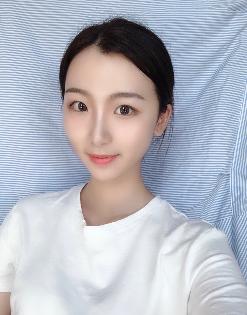 宁波艺星医疗美容医院刘卫做鼻部整形怎么样？附鼻部案例