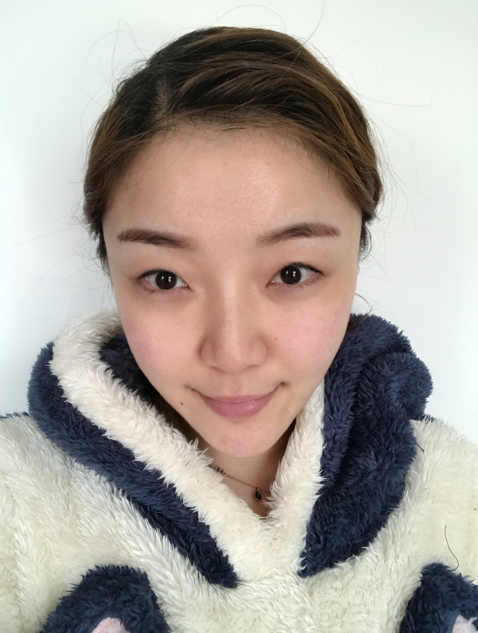 广东画美医疗美容医院价格表,附双眼皮案例