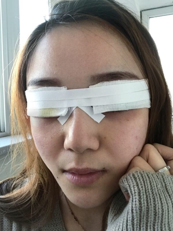 广东画美医疗美容医院价格表,附双眼皮案例