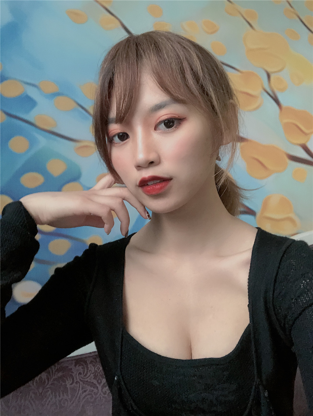 上海德琳医疗美医院价格表，附隆胸案例