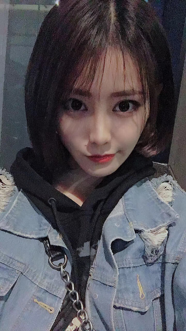 长沙雅美医疗美容医院田芳斌隆鼻好吗？附隆鼻案例