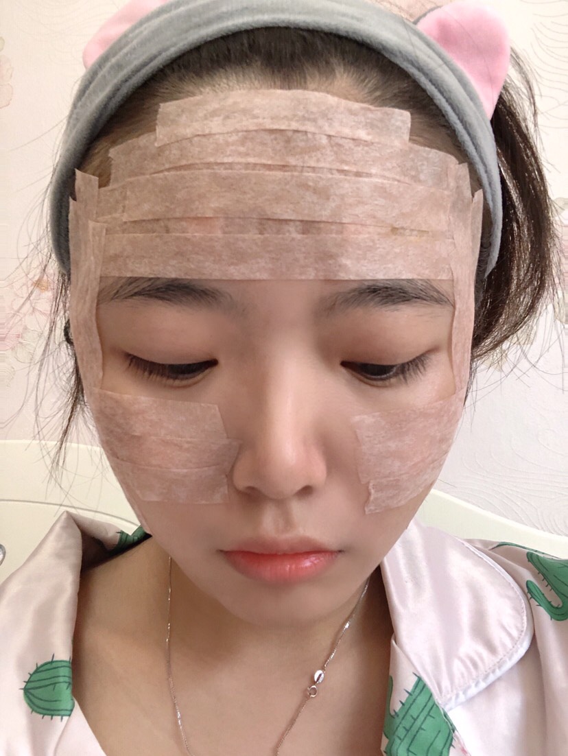 阜阳东方美莱坞医疗美容价格表，附自体脂肪全脸填充案例