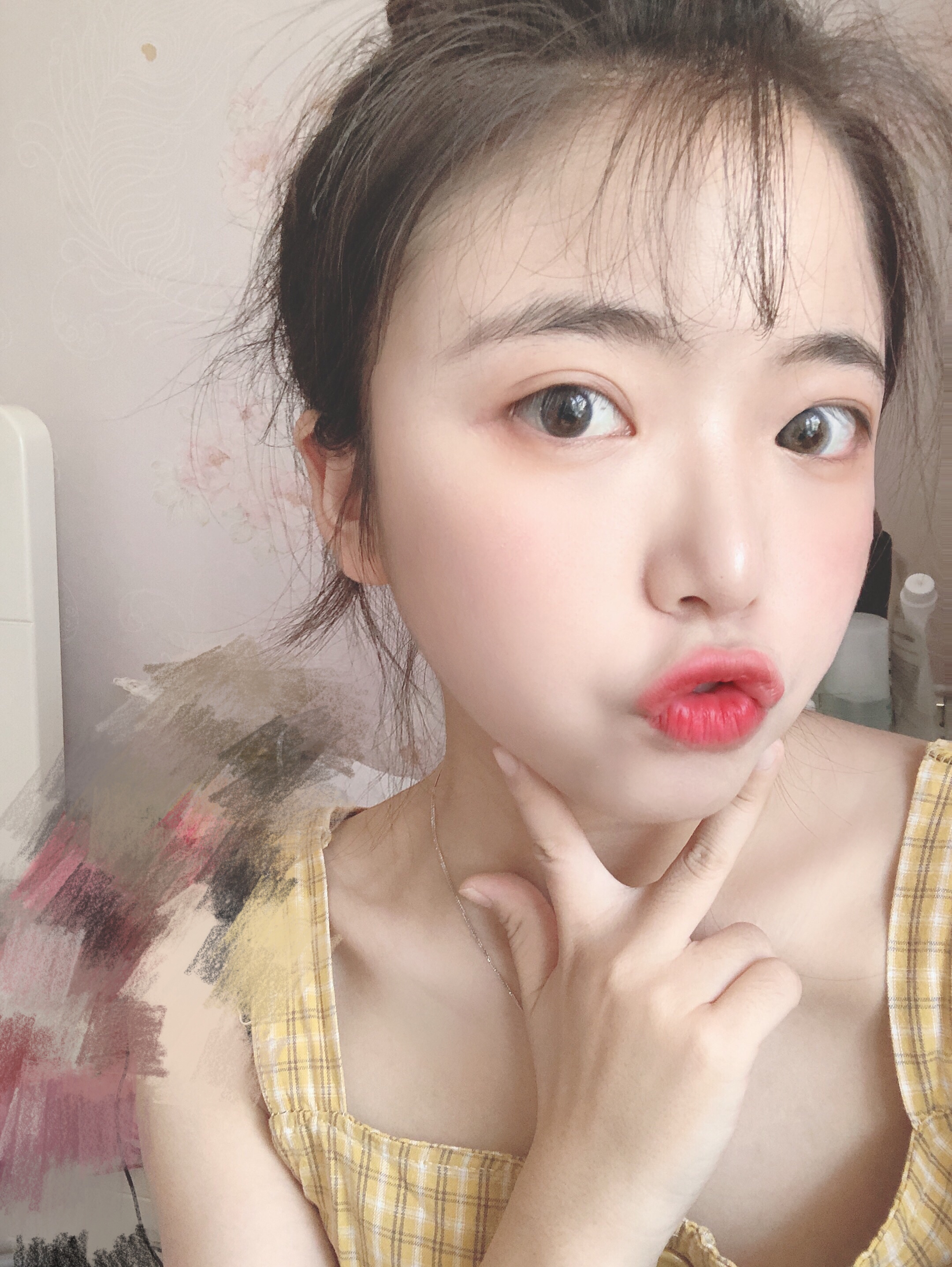 阜阳东方美莱坞医疗美容价格表，附自体脂肪全脸填充案例