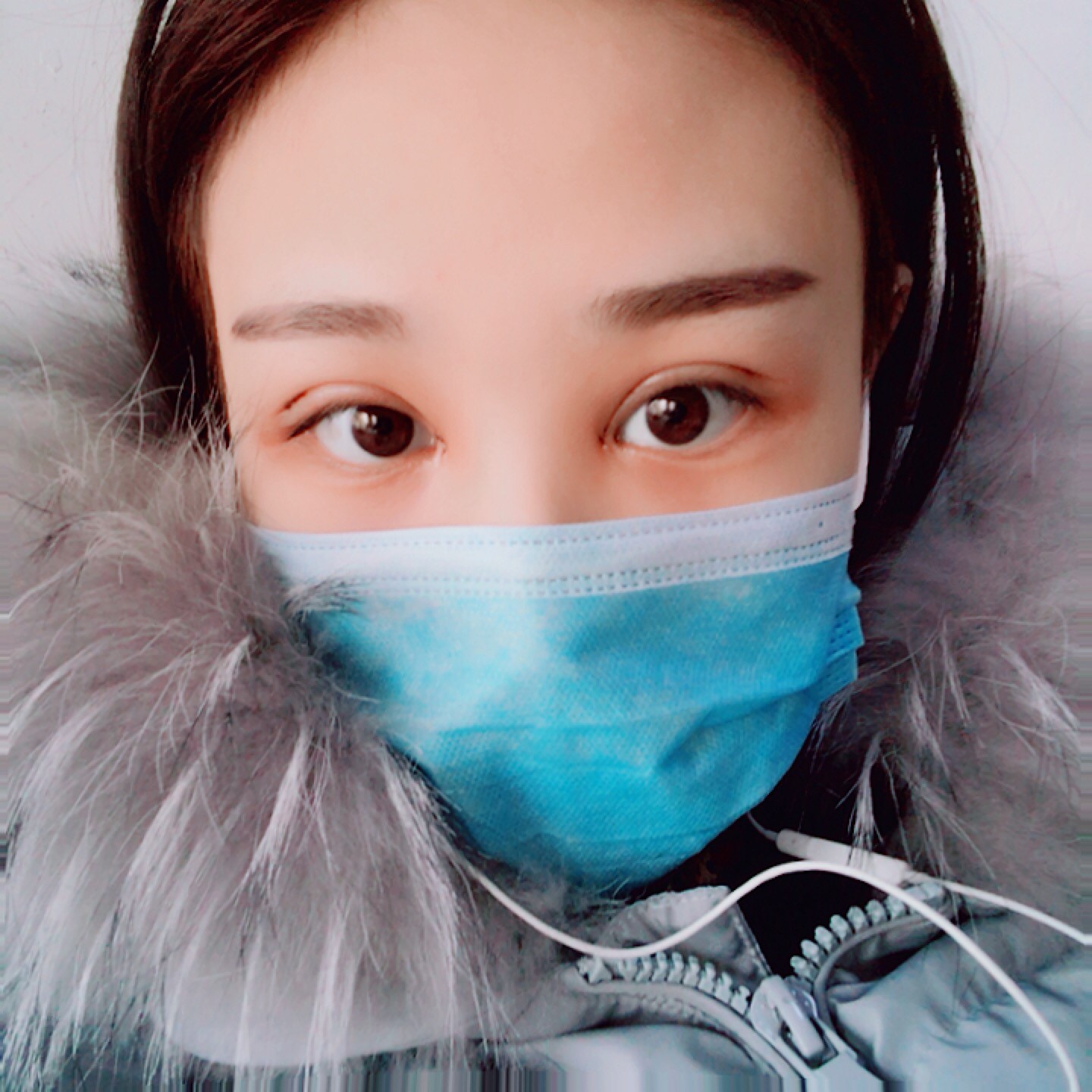 南昌韩美美容医院价格表,附双眼皮案例