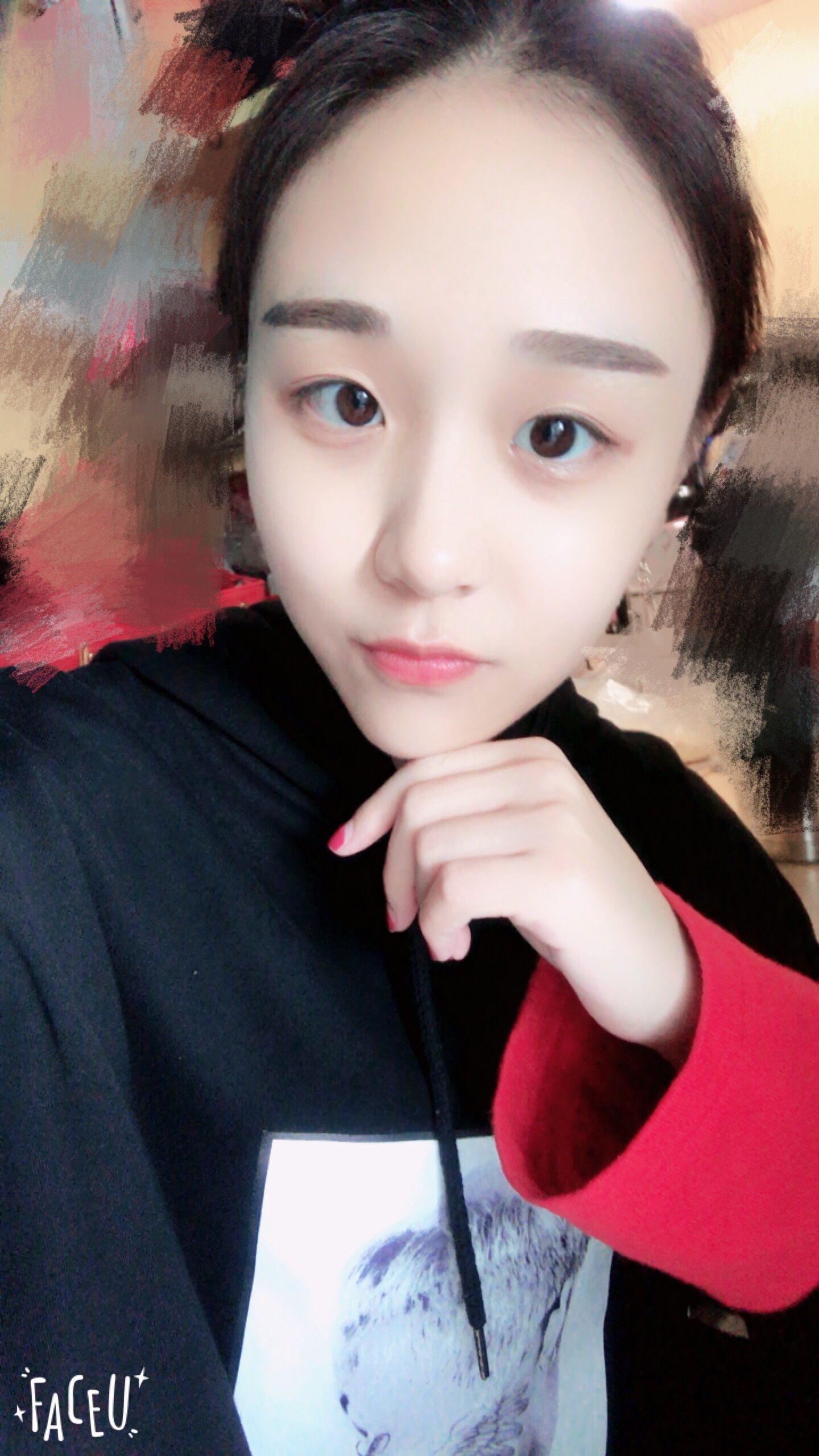 南昌韩美美容医院价格表,附双眼皮案例