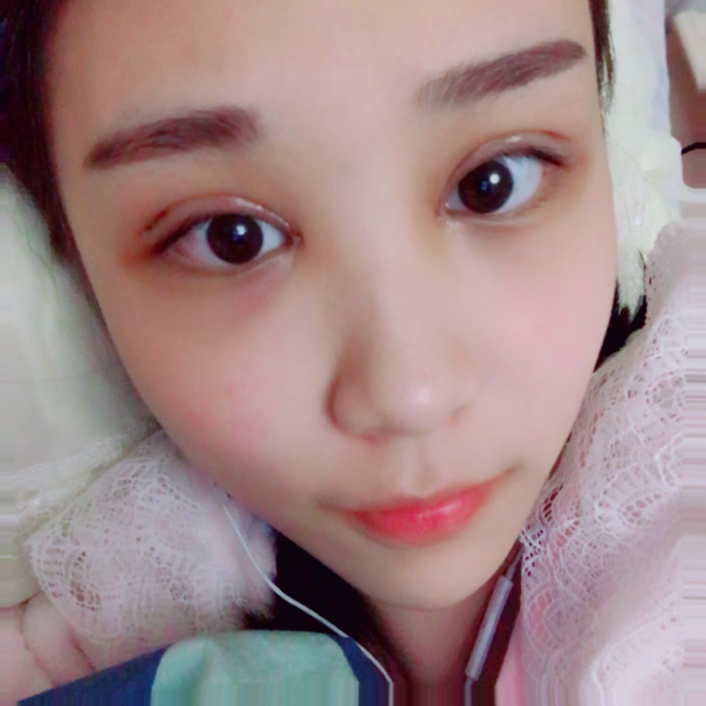 南昌韩美美容医院价格表,附双眼皮案例