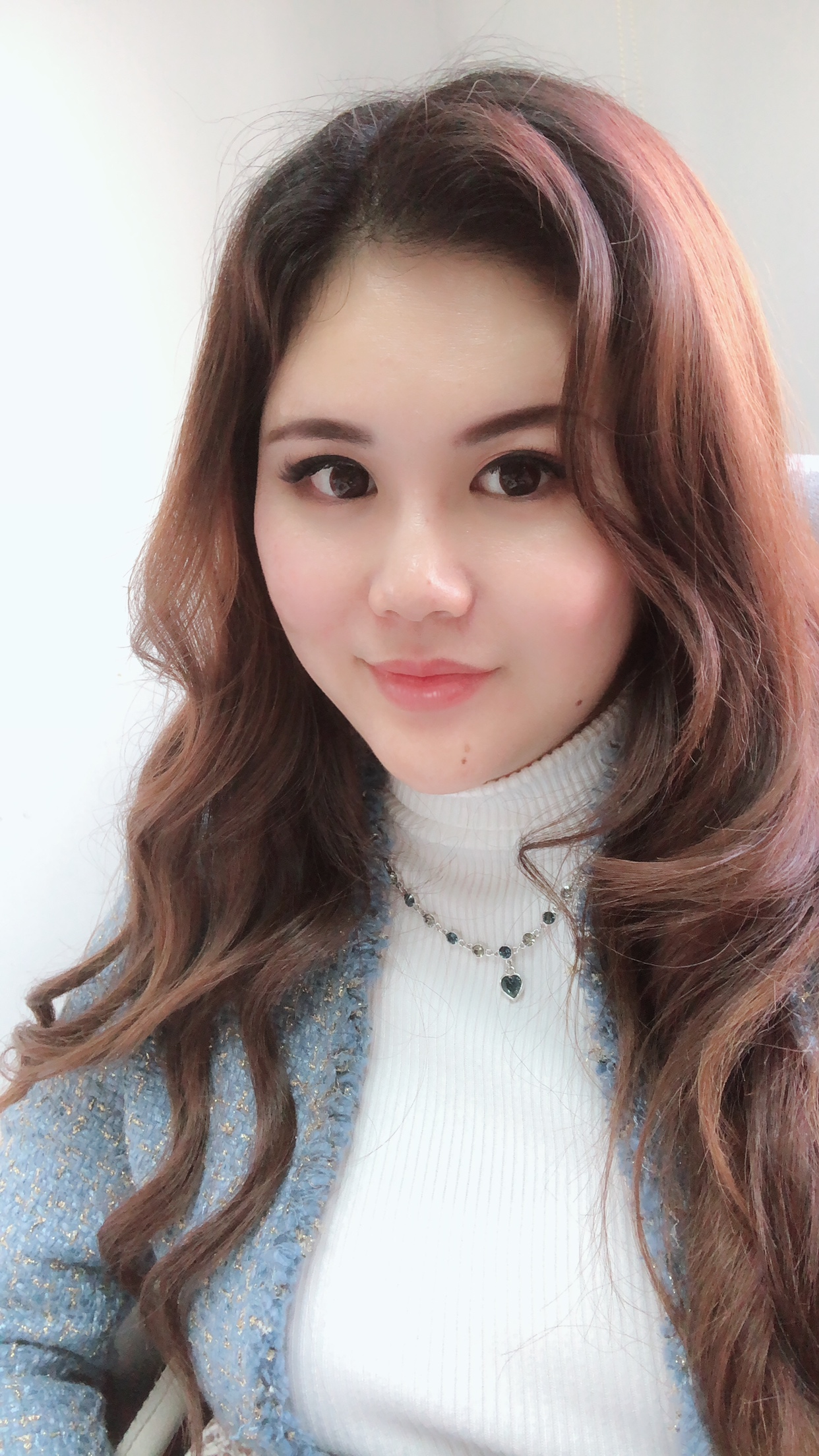 北京首玺丽格医疗美容诊所价格表，附埋线提升案例