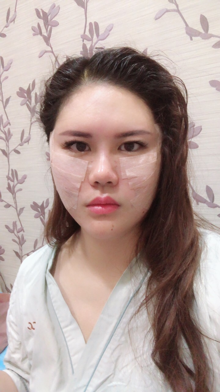 北京首玺丽格医疗美容诊所价格表，附埋线提升案例