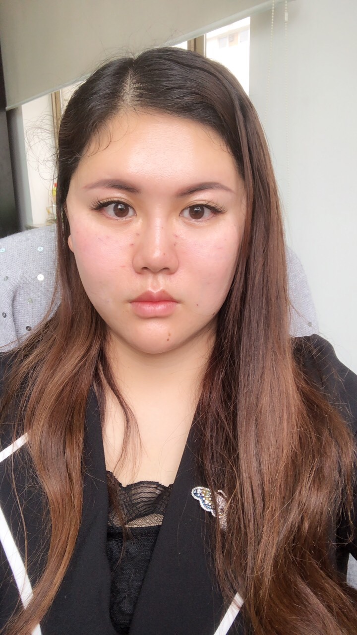 北京首玺丽格医疗美容诊所价格表，附埋线提升案例