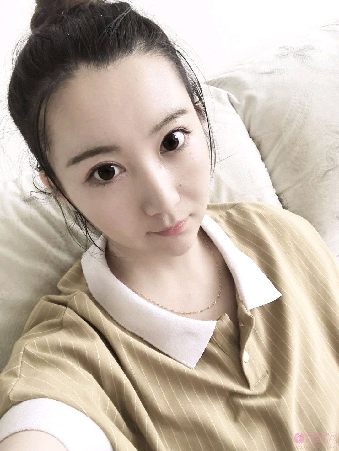 成都西区医院整形毛健清医生脂肪填充怎么样，附价格表