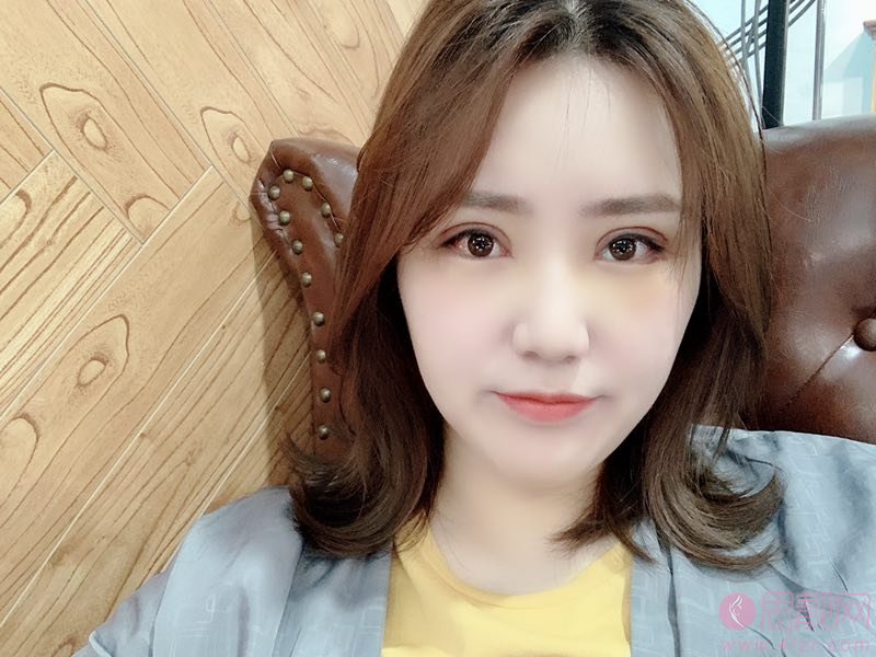 北京彤美刘风卓修复双眼皮怎么样，附双眼皮修复真人案例