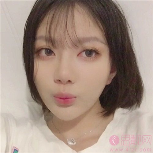 上睑提肌价格