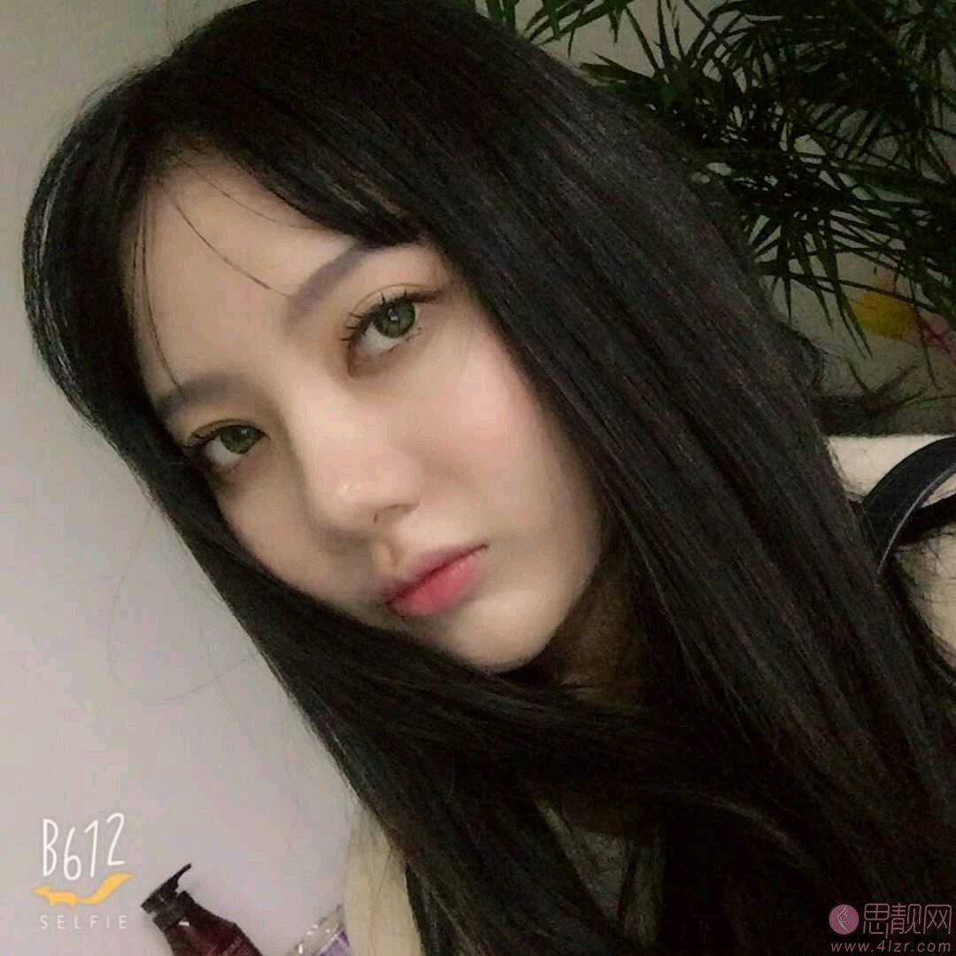 上睑提肌价格