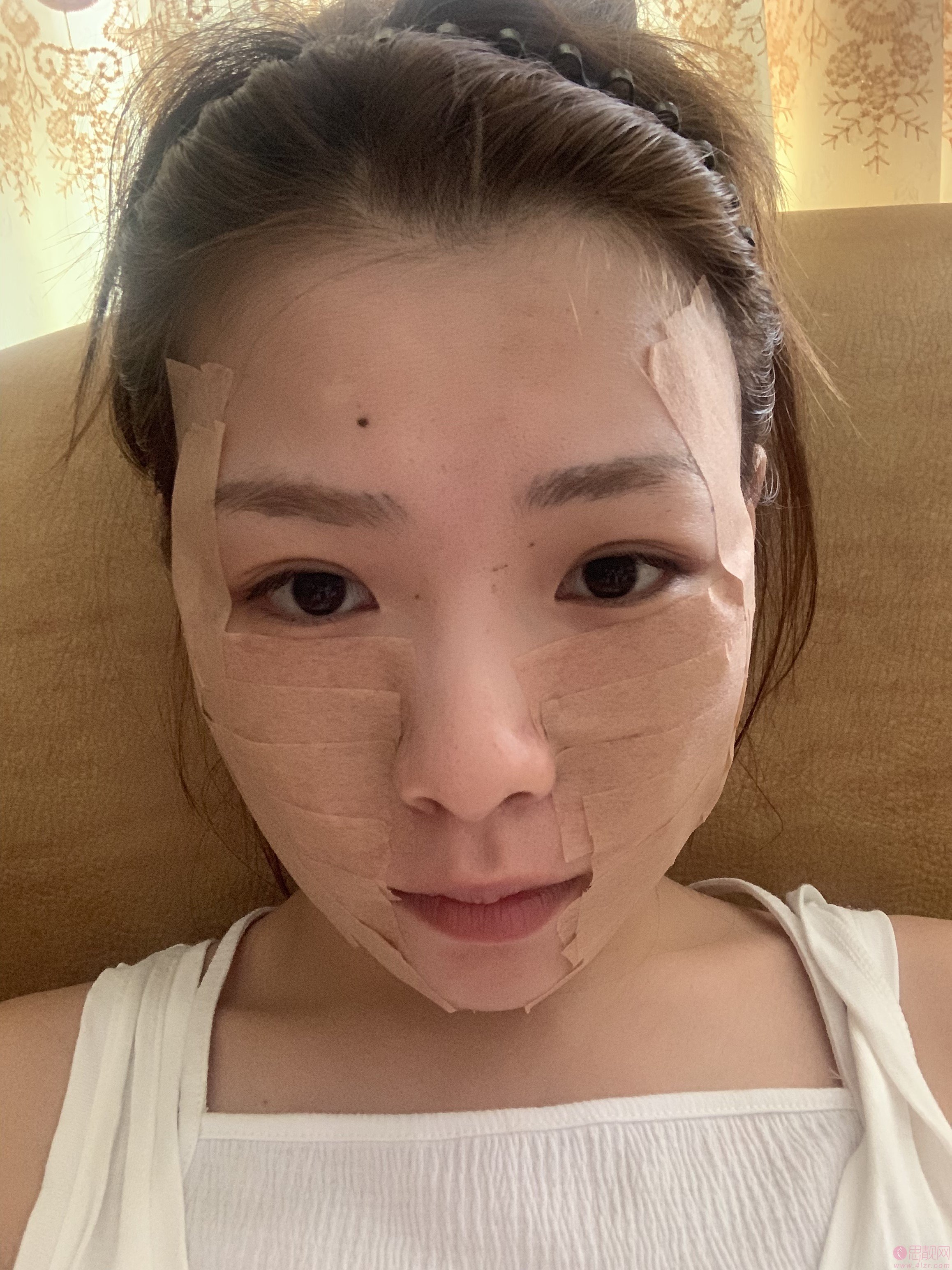 南京艺星整形医院吕永全技术好不好，附自体脂肪全脸填充及价格表