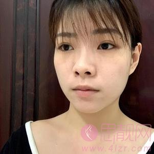 南京艺星整形医院吕永全技术好不好，附自体脂肪全脸填充及价格表