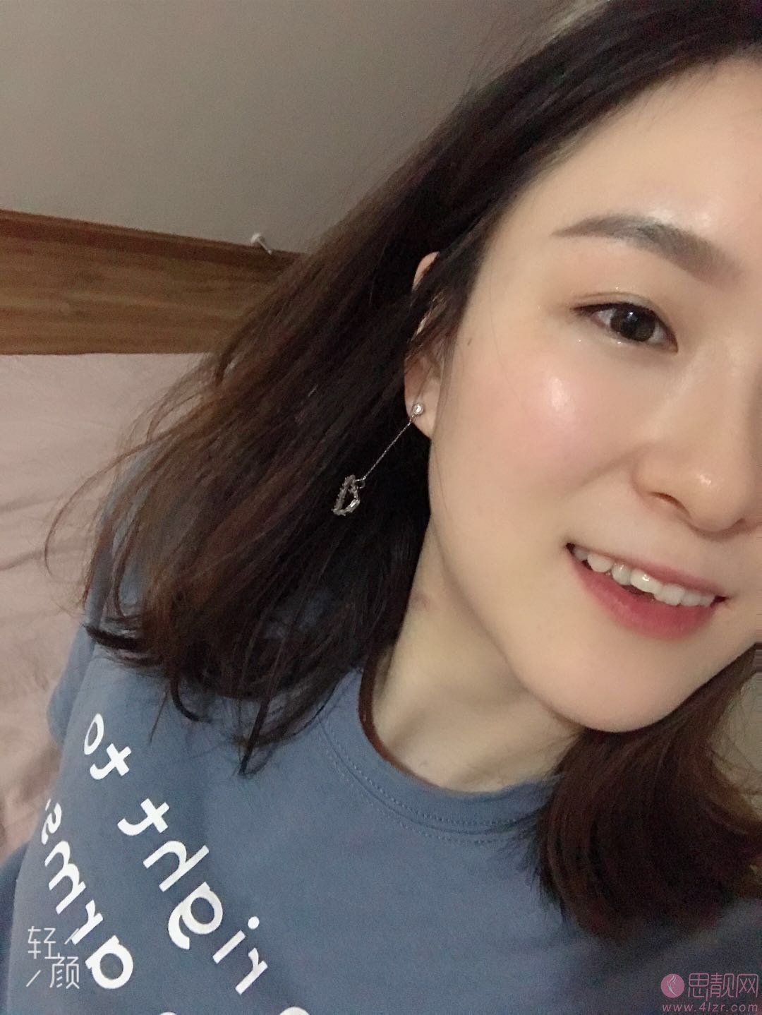 成都圣贝牙科做牙齿隐形矫正怎么样？