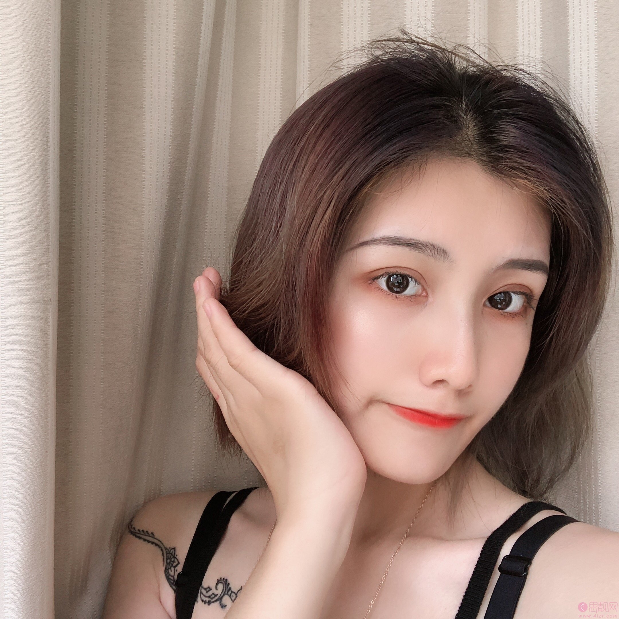 深圳鹏爱医疗美容医院价格表，附双眼皮案例