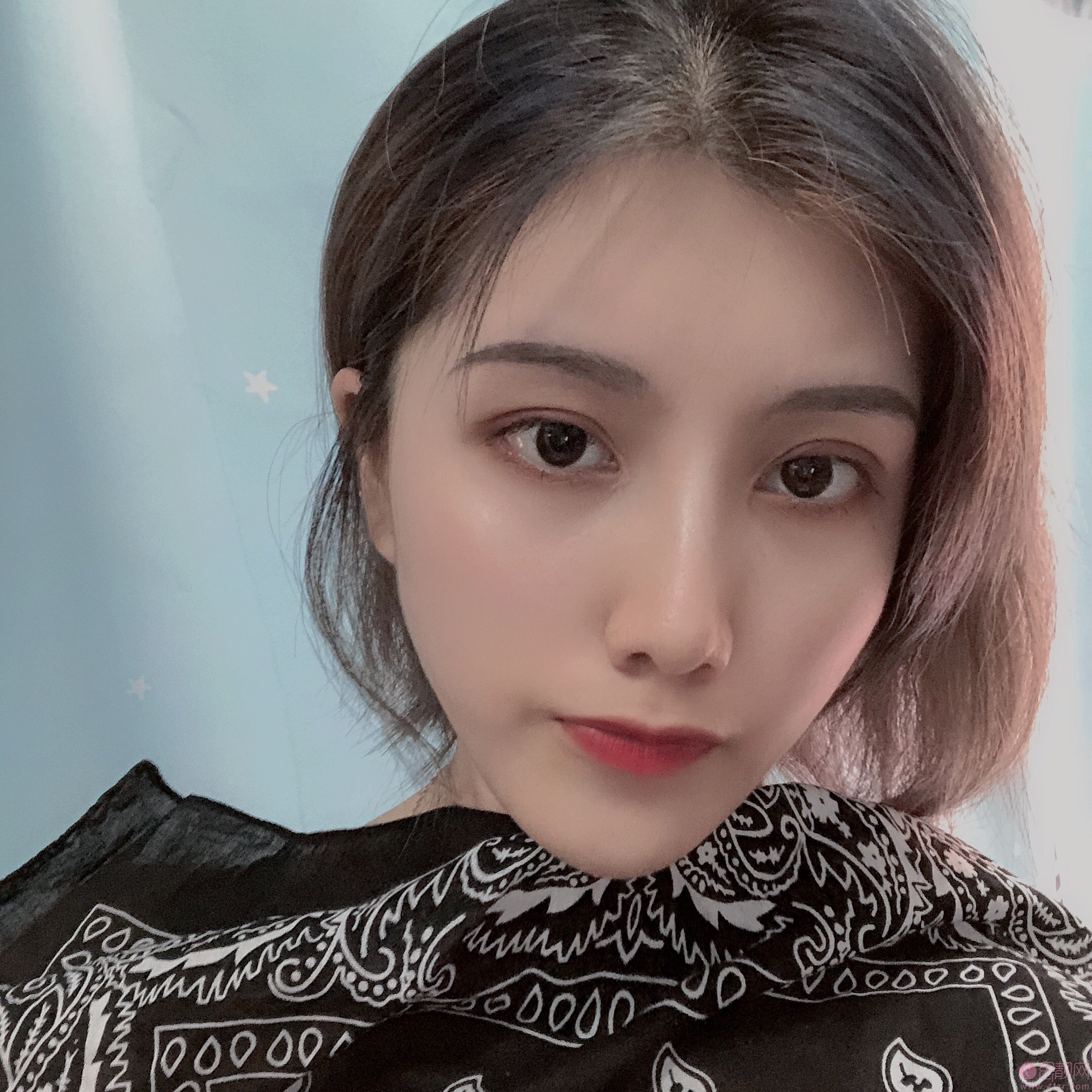 深圳鹏爱医疗美容医院价格表，附双眼皮案例