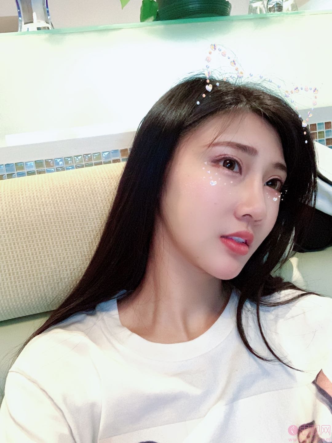 成都美未央周鹏起医生怎么样？附外眼角下至加祛眼袋案例分享