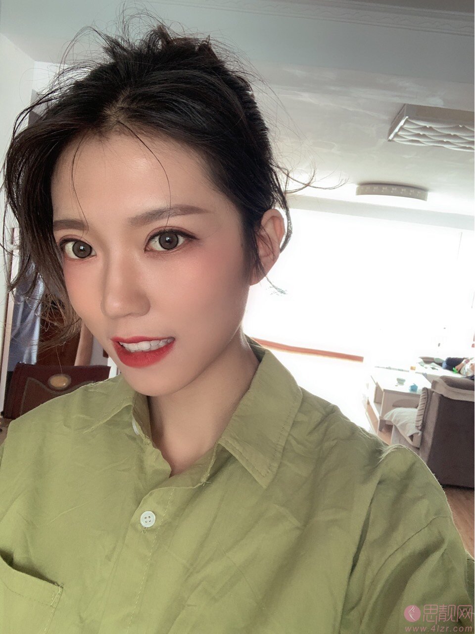 攀枝花学院附属医院整形美容科价格表，附双眼皮真人案例