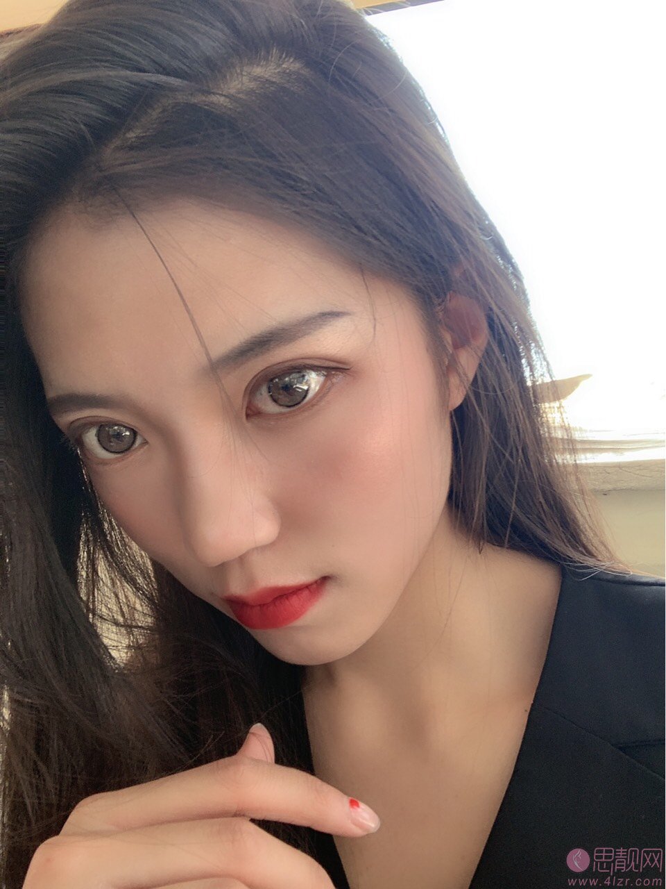 攀枝花学院附属医院整形美容科价格表，附双眼皮真人案例