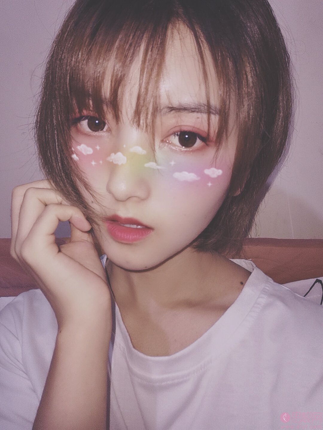 北京煤炭总医院整形科王英勇做双眼皮怎么样，附双眼皮案例及价格