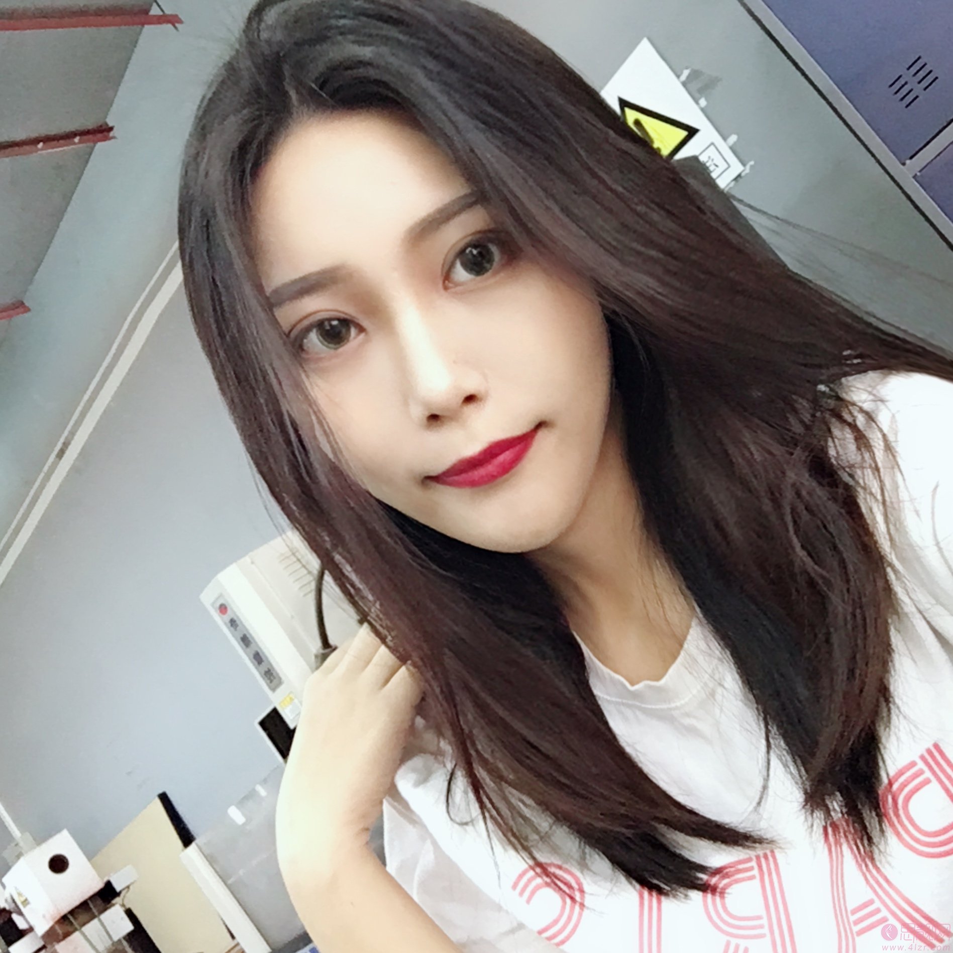 贵阳颜之美医疗整形医院价格表，附玻尿酸瘦脸案例