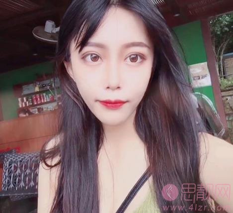 贵阳颜之美医疗整形医院价格表，附玻尿酸瘦脸案例