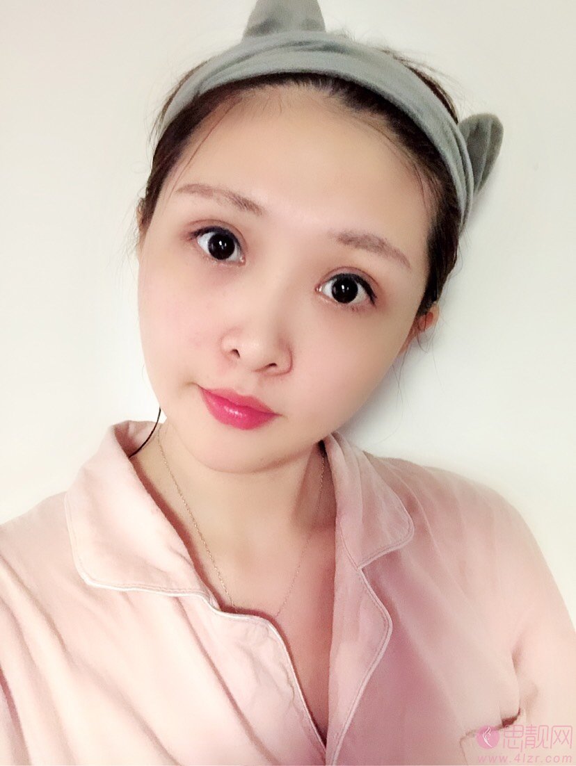 湘潭爱思特整形价格表，附双眼皮经典案例
