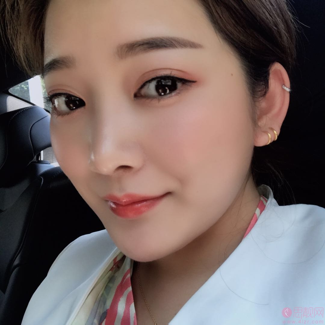 四川华人医联整形美容医院做鼻子多少钱，附2020最新价格表